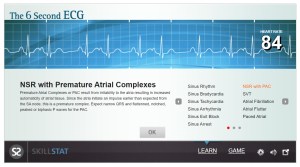 SIMULADOR ELECTROCARDIOGRAMAS SKILLSTAT GRATUITO: A PRACTICAR ...